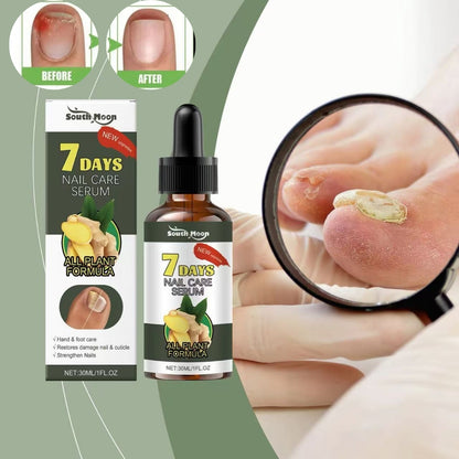 NailCareSerum® | Corta la infección desde la raíz.