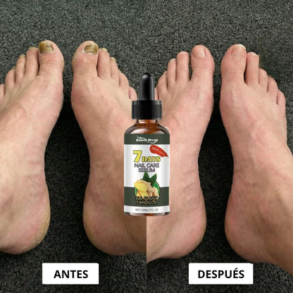 NailCareSerum® | Corta la infección desde la raíz.
