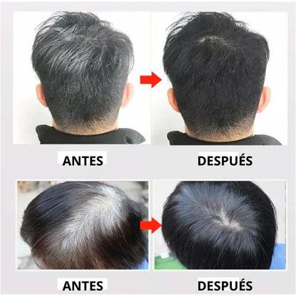 Shampoo Black Hair Dye | Recupera tu tono natural sin tintes: adiós a las canas con un solo lavado