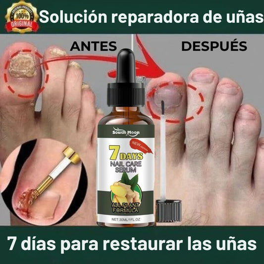 NailCareSerum® | Corta la infección desde la raíz.