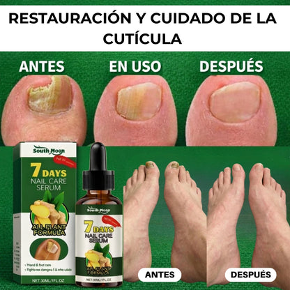 NailCareSerum® | Corta la infección desde la raíz.